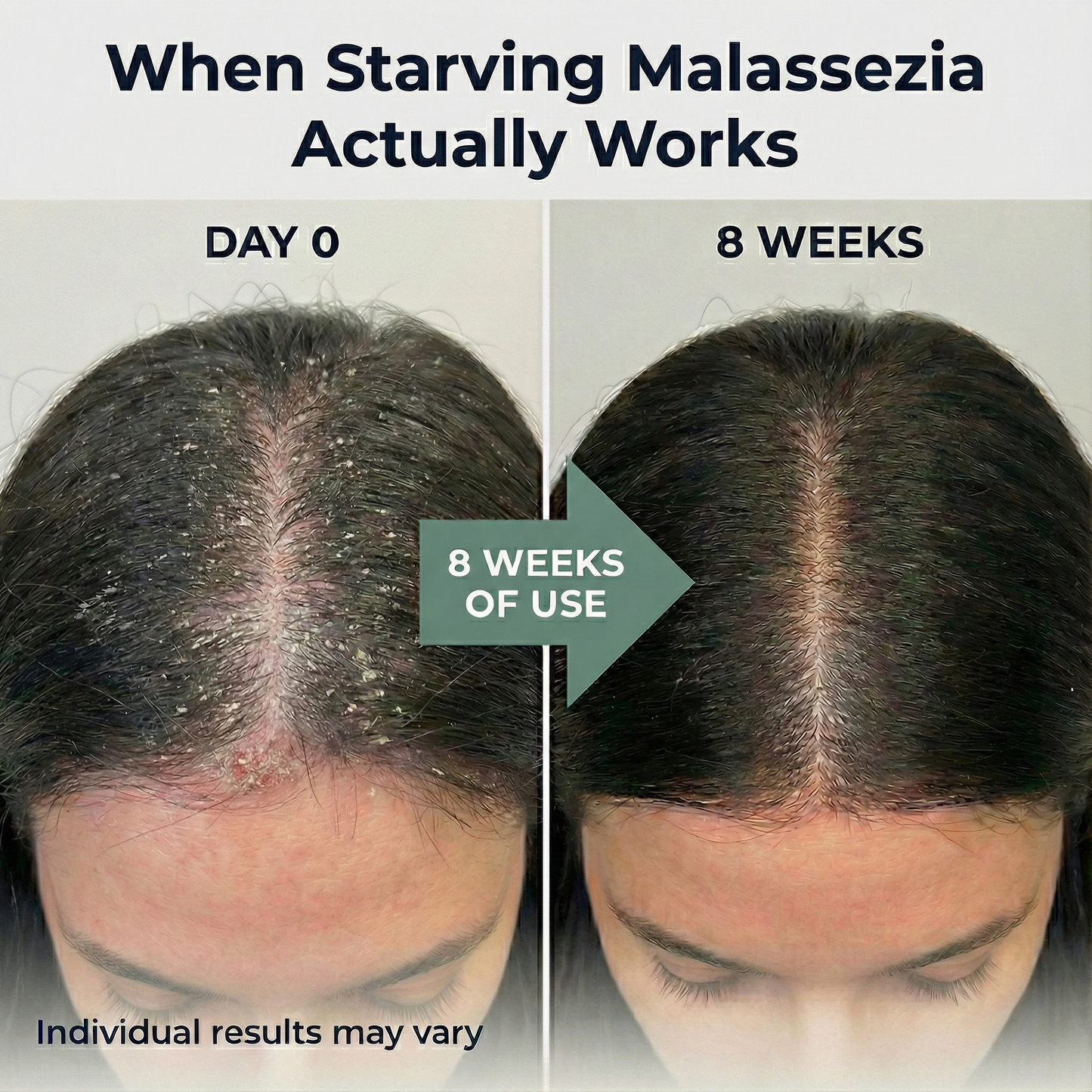 MalaZero C8/C10 MCT Oil